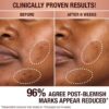 SERUM WYRÓWNAJĄCE CIEMNE PLAMY I PRZYWRACAJĄCE BLASK 10 ML